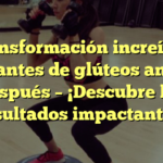 Transformación increíble: Implantes de glúteos antes y después – ¡Descubre los resultados impactantes!